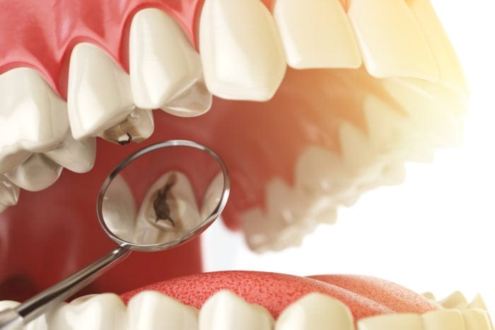 ThinkstockPhotos-616014686-700x467